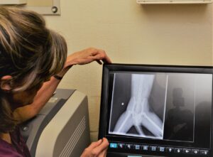 a woman (partially on screen) looks at a monitor with an x-ray image